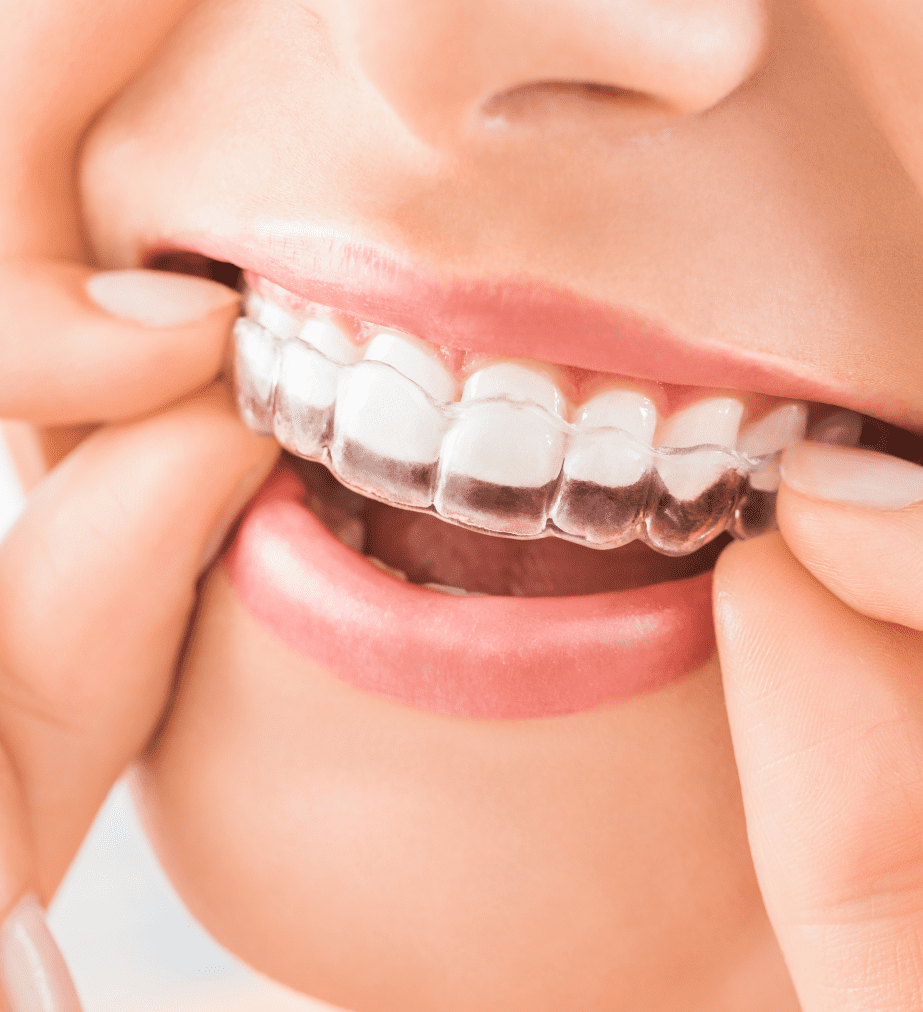 invisalign philadelphia