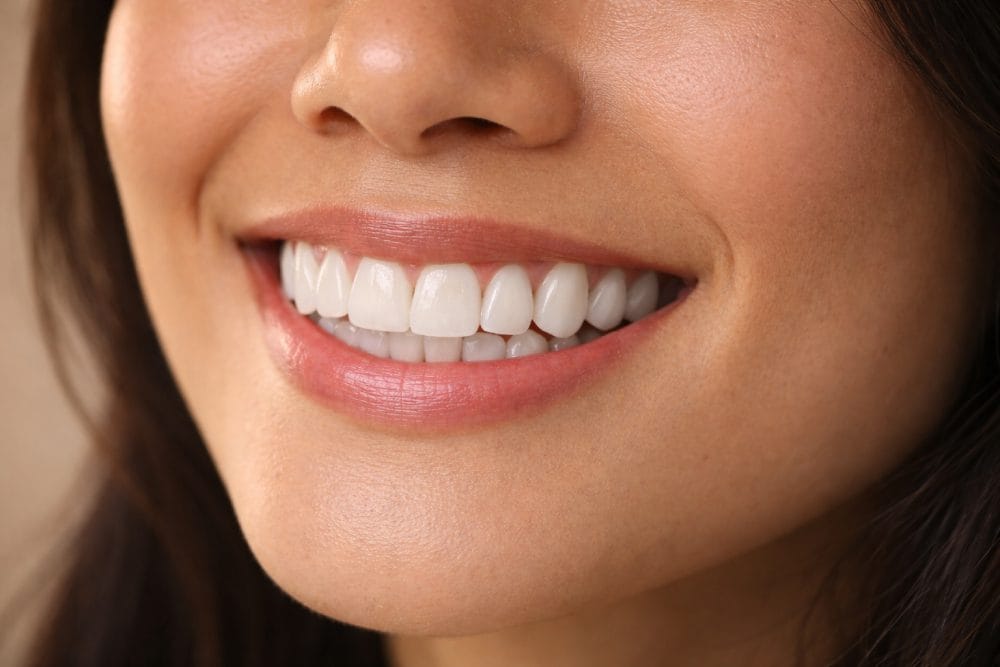 How-Long-Does-Full-Mouth-Reconstruction-Take