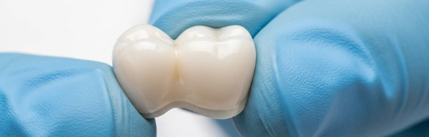 dental onlay restoration Philadelphia