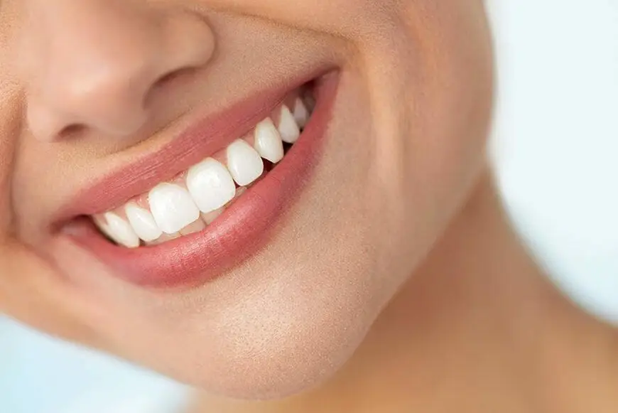 Porcelain Inlay Philadelphia: Dental Inlays & Onlays