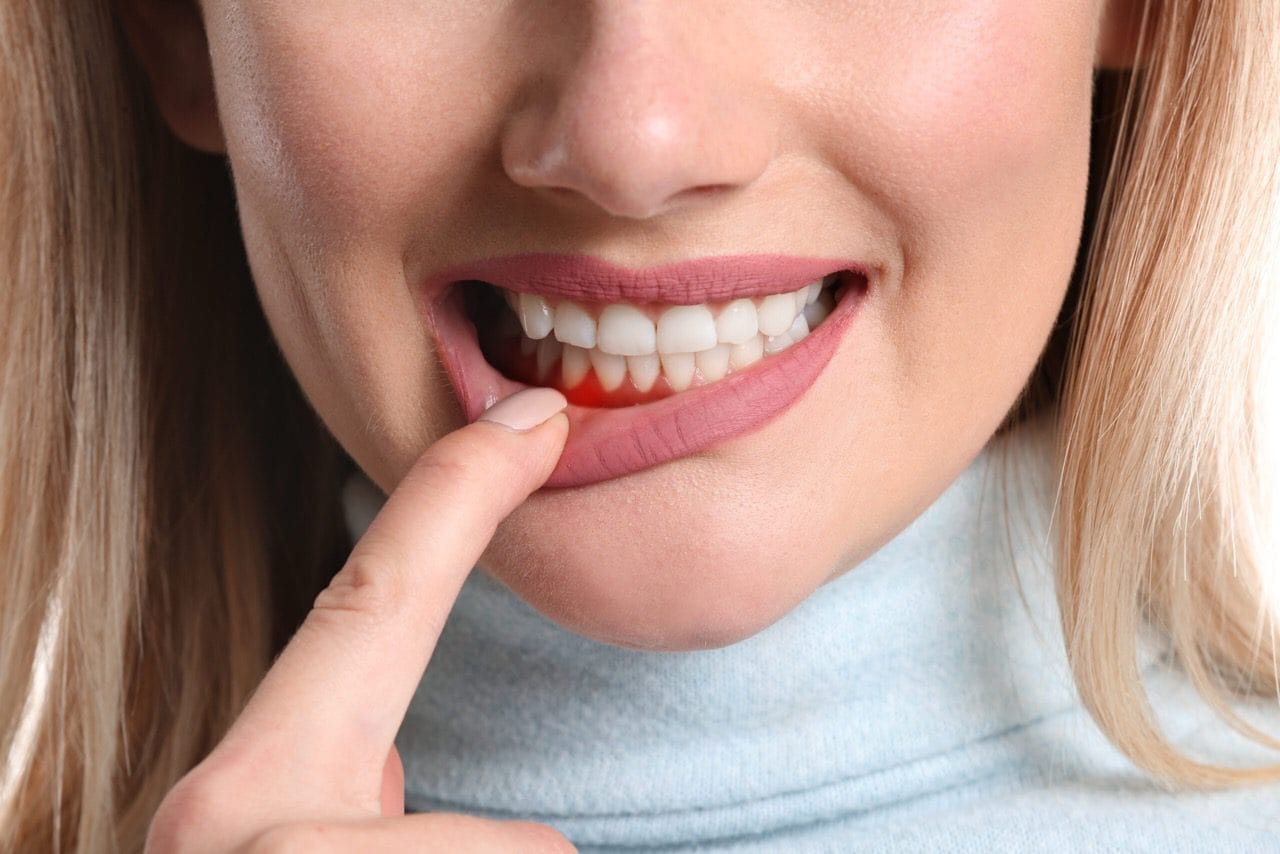 how to fix receding gums